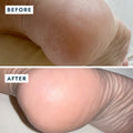 heel before and after