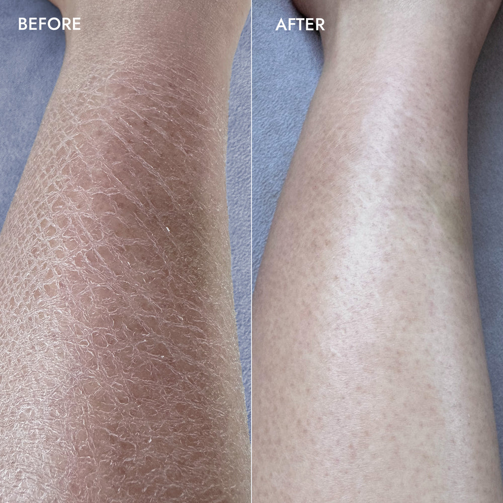 Exfoliating Body Wash Black Tea & Rosé - Sugar Scrub with Plant-Derived AHAs